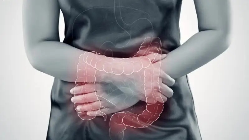 Enfermedad inflamatoria intestinal: causas, síntomas y cómo se diagnostica